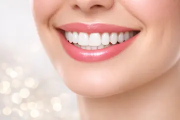 Esthétique du sourire